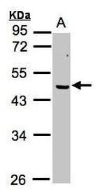 ERCC8 Antibody in Western Blot (WB)