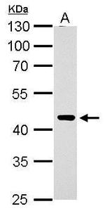 ERCC8 Antibody in Western Blot (WB)