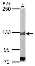 DDB1 Antibody in Western Blot (WB)