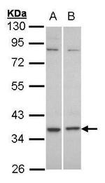GPR77 Antibody in Western Blot (WB)