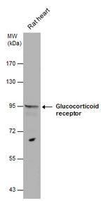 Glucocorticoid Receptor Antibody in Western Blot (WB)