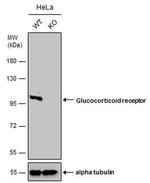Glucocorticoid Receptor Antibody