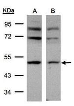 AP2M1 Antibody in Western Blot (WB)
