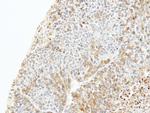 CAPZB Antibody in Immunohistochemistry (Paraffin) (IHC (P))