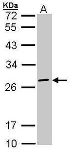 eIF3k Antibody in Western Blot (WB)