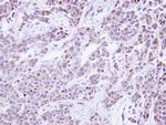 GANAB Antibody in Immunohistochemistry (Paraffin) (IHC (P))