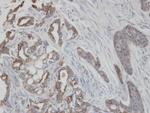 Cytokeratin 2e Antibody in Immunohistochemistry (Paraffin) (IHC (P))