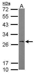 RANBP1 Antibody in Western Blot (WB)