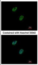 GABPB1 Antibody in Immunocytochemistry (ICC/IF)