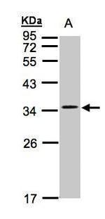 CACNG5 Isoform B Antibody in Western Blot (WB)