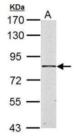 HSD17B4 Antibody in Western Blot (WB)