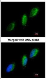 TYK2 Antibody in Immunocytochemistry (ICC/IF)