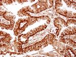 ME1 Antibody in Immunohistochemistry (Paraffin) (IHC (P))