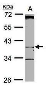 BHMT2 Antibody in Western Blot (WB)