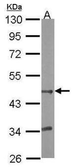 BHMT2 Antibody in Western Blot (WB)