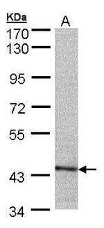 PSMC6 Antibody in Western Blot (WB)