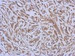 ENTPD3 Antibody in Immunohistochemistry (Paraffin) (IHC (P))