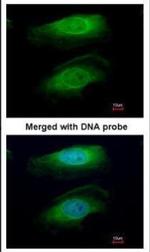 RICTOR Antibody in Immunocytochemistry (ICC/IF)