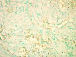 RICTOR Antibody in Immunohistochemistry (IHC)