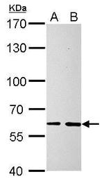 SOCS5 Antibody in Western Blot (WB)