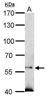 SOCS5 Antibody in Western Blot (WB)