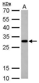 CTDSP2 Antibody in Western Blot (WB)