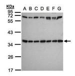 RPS3A Antibody in Western Blot (WB)