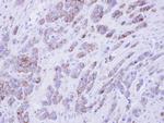 PLSCR1 Antibody in Immunohistochemistry (Paraffin) (IHC (P))