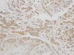 C1 inhibitor Antibody in Immunohistochemistry (Paraffin) (IHC (P))