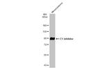 C1 inhibitor Antibody in Western Blot (WB)
