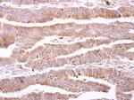 FABP6 Antibody in Immunohistochemistry (Paraffin) (IHC (P))