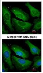 PP1 gamma Antibody in Immunocytochemistry (ICC/IF)