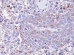 PP1 gamma Antibody in Immunohistochemistry (Paraffin) (IHC (P))