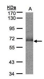 SUOX Antibody in Western Blot (WB)