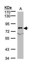 SHKBP1 Antibody in Western Blot (WB)