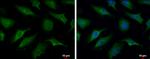 TRIM37 Antibody in Immunocytochemistry (ICC/IF)