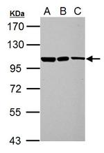 TRIM37 Antibody in Western Blot (WB)