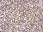 TRIM37 Antibody in Immunohistochemistry (Paraffin) (IHC (P))