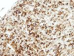 STAP2 Antibody in Immunohistochemistry (Paraffin) (IHC (P))