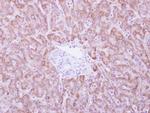 ANKRD45 Antibody in Immunohistochemistry (Paraffin) (IHC (P))