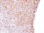 Coronin 1B Antibody in Immunohistochemistry (Paraffin) (IHC (P))