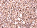 GLYATL1 Antibody in Immunohistochemistry (Paraffin) (IHC (P))