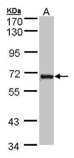 DENND1B Antibody in Western Blot (WB)