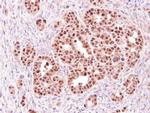 ALOXE3 Antibody in Immunohistochemistry (Paraffin) (IHC (P))