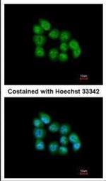 MBNL3 Isoform G Antibody in Immunocytochemistry (ICC/IF)