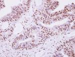 SEPHS1 Antibody in Immunohistochemistry (Paraffin) (IHC (P))