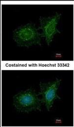 SH3BP1 Antibody in Immunocytochemistry (ICC/IF)