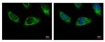 HPS3 Antibody in Immunocytochemistry (ICC/IF)