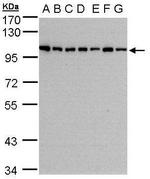 HPS3 Antibody in Western Blot (WB)