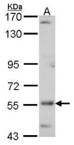 ADCK4 Antibody in Western Blot (WB)